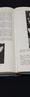 Odontología Operatoria William Gilmore 1973 Interamericana — Coleccionables vintage, años 70s (foto 9)